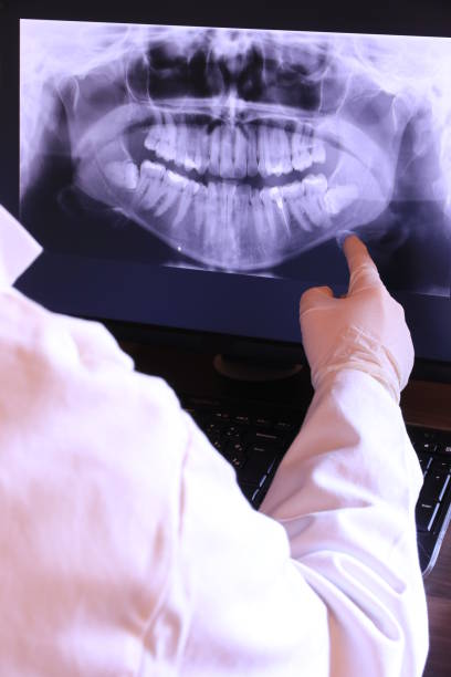 Best Emergency Tooth Extraction in Fort Polk South, LA