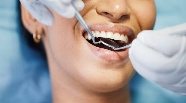 Best Walk-In Emergency Dentist in Fort Polk South, LA